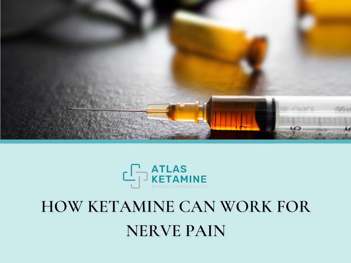 How Ketamine Can Work for Nerve Pain Atlas Ketamine
