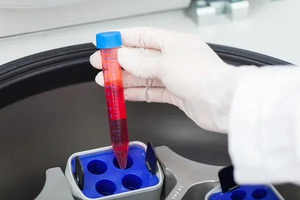 scientist holding a laboratory centrifuge filled with red substances